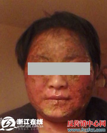 “如新”公司遭浙江消费者投诉